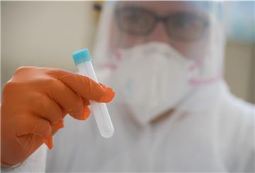 151 Corona-Infektionen sind bislang in der Wesermarsch nachgewiesen.