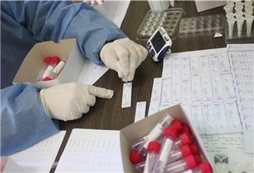Eine Person des Gesundheitswesens wertet im Al-Shifa Medical Complex in Gaza-Stadt eine Abstrichprobe für einen Corona-Test aus.