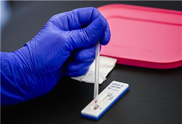 Auch in Zeben werden bald wieder Blutproben auf Teststreifen für das Coronavirus gegeben.