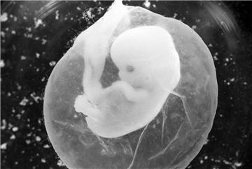 Das Foto zeigt einen sieben Wochen alten Fötus in einer Fruchtblase. Die Zahl der Abtreibungen ist im Jahr 2017 (101.209 Abbrüche) gegenüber dem Vorjahr (98.721 Abbrüche) in Deutschland um zweieinhalb Prozent gestiegen, im Vergleich zu den Jahren 2005 oder 2010 sind die Zahlen rückläufig.