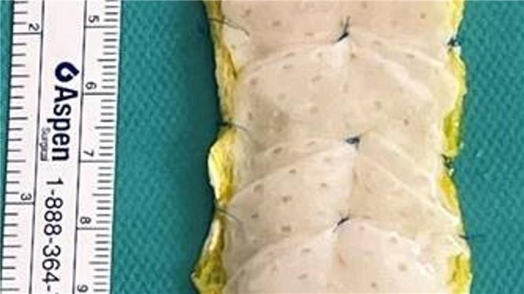Das „Herzpflaster“ wird aus Einzelteilen zusammengesetzt. 