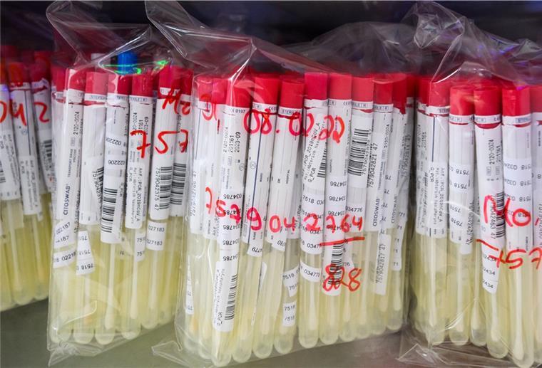 PCR-Tests von Patienten liegen im Labor Nordlab in einem Kühlschrank