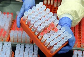 Dem niedersächsischen Landesgesundheitsamt in Hannover sind bisher landesweit 32 Fälle der Gamma-Variante bekannt geworden.