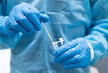 Derzeit sind 402 Wesermärschlerinnen und Wesermärschler mit dem Corona-Virus infiziert, mehr als ein Viertel von ihnen wohnt in Nordenham (110).