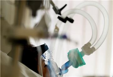 Ein Mensch wird im Krankenhaus künstlich beatmet. 