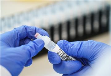Die Mitarbeiterin eines Labors hält eine Probe in den Händen. Die zunächst in Großbritannien entdeckte Corona-Variante B.1.1.7 breitet sich nach Beobachtung eines großen Laborverbands in Deutschland weiter aus.