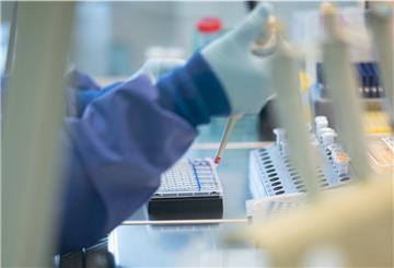 Eine Mitarbeiterin arbeitet an einer Sicherheitswerkbank in einem Labor im Institut für Hygiene und Gesundheit, dabei mischt sie isolierte RNA aus Abwasserproben mit PCR-Reagentien für die spezifische Detektion von SARS-CoV-2