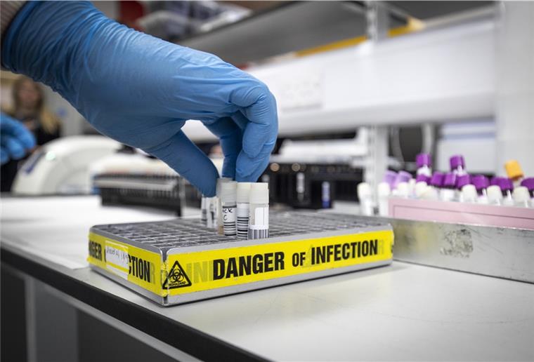 Bremerhavener (39) positiv auf Coronavirus getestet Ein Bremerhavener hat sich mit dem Corona-Virus infiziert.