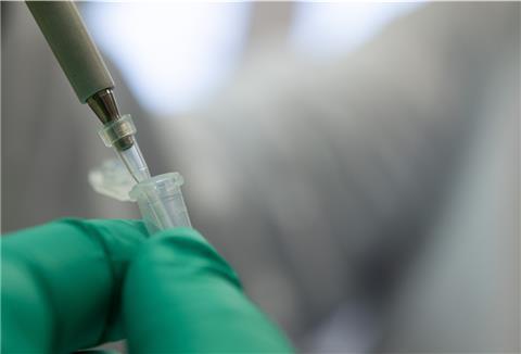 Ein Forscher zeigt im Landesgesundheitsamt Baden-Württemberg, wie ein PCR-Test für die Analyse auf Mutationen des Coronavirus vorbereitet wird.