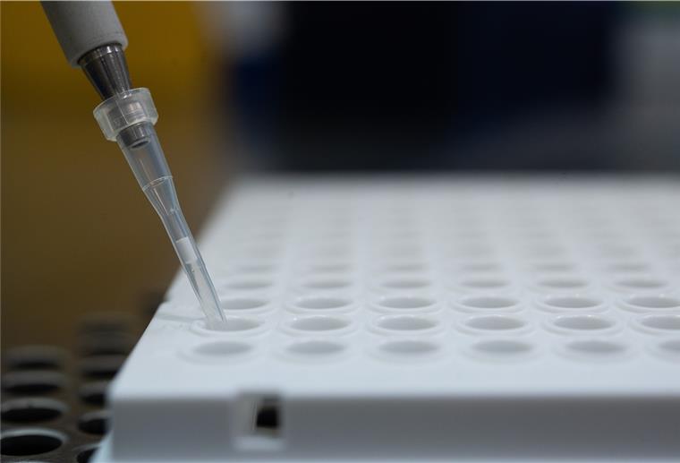 Ein Forscher zeigt im Landesgesundheitsamt Baden-Württemberg, wie ein PCR-Test für die Analyse auf Mutationen des Coronavirus vorbereitet wird.
