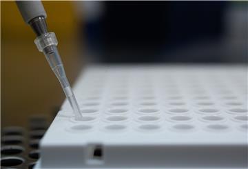 Ein Forscher zeigt im Landesgesundheitsamt Baden-Württemberg, wie ein PCR-Test für die Analyse auf Mutationen des Coronavirus vorbereitet wird.