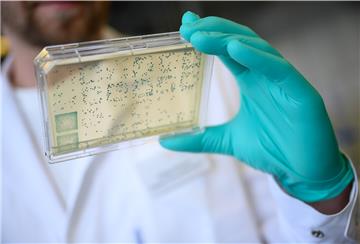 Ein Mann schaut sich in einem Labor des biopharmazeutischen Unternehmens Curevac einen Träger mit Bakterien an.
