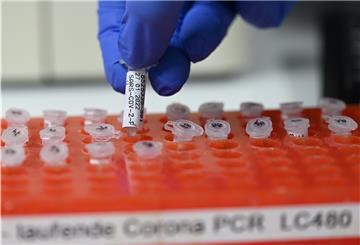 Eine Mitarbeiterin des PCR Testlabors bereitet PCR Tests vor.