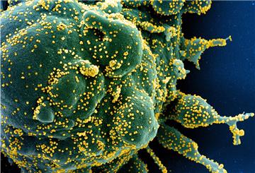 Eine grüne Zelle ist mit dem Coronavirus (SARS-CoV-2, gelb) infiziert. 