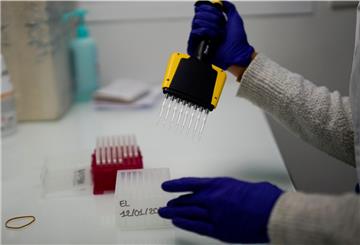 Eine Medizintechnikerin bereitet Proben vor, um sie auf eine hochansteckende Coronavirus-Mutation zu untersuchen.