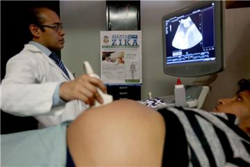 Eine schwangere Frau wird in Guatemala per Ultraschall untersucht. Der Zika-Virus kann bei Babys Schädelfehlbildungen verursachen.  Foto Biba/dpa