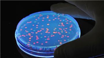 Fluoreszierende Samonellen liegen unter Schwarzlicht im Labor des Helmholtz-Zentrums in Braunschweig.