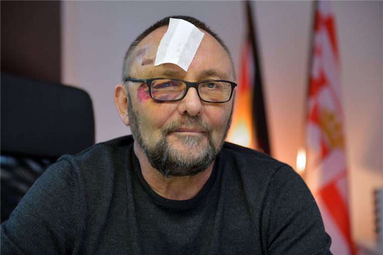 200 Hinweise nach Angriff auf AfD-Politiker Magnitz Frank Magnitz, Landesvorsitzender der AfD Bremen, wurde im Januar von unbekannten Tätern angegriffen.