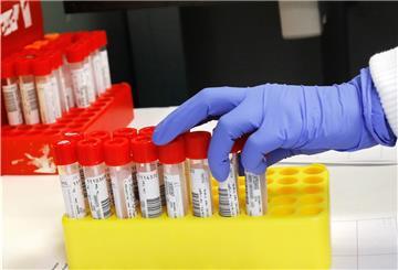 Ein Mikrobiologe untersucht im Labor Proben für PCR-Tests