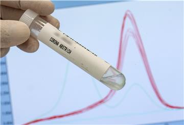 Ein leeres Abstrichröhrchen zur Analyse des Corona-Virus wird im Labor der Firma „Bioscientia“ zu Illustrationszwecken vor einen Monitor gehalten, auf dem ein sogenannter „Schmelzkurvenverlauf“ der „Delta-Variante“ des Virus dargestellt ist.