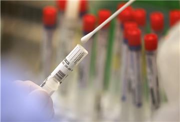 Im Laufe der vergangenen Monate sind in der Wesermarsch 73 Menschen positiv auf das Virus getestet worden. Von denen sind 70 wieder gesund, einer ist noch erkrankt, zwei sind verstorben.