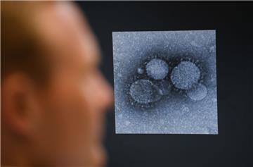 In Bremerhaven gibt es einen Verdachtsfall auf das Coronavirus, so das Gesundheitsamt.