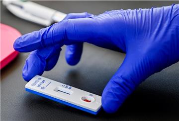  Ein Test für das neuartige Coronavirus wird im Stadtzentrum in einer Hand gehalten.