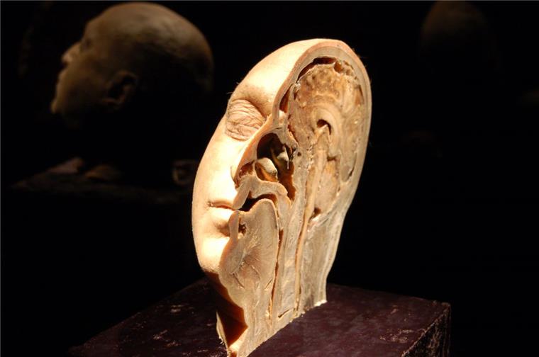 Verbot für nachgeahmte Körperwelten-Ausstellung in Bremerhaven In Bremerhaven wird die nachgeahmte Körperwelten-Ausstellung nicht gezeigt. Sie bekam vom Bürger- und Ordnungsamt keine Genehmigung.