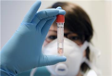 In Cuxhaven wurden weitere 21 Menschen positiv auf das neue Coronavirus getestet. Das Virus trat vor allem in zwei Großfamilien im Stadtgebiet auf.
