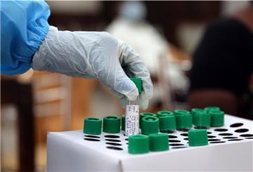 Ein Mitarbeiter des Gesundheitswesens hält in einem Regierungsbüro in Chennai eine Probe für einen RT-PCR-Test in der Hand.