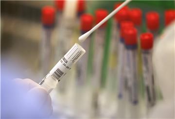 In Deutschland steigt die Zahl an Neuinfektionen mit dem Corona-Virus um 1045 neue Fälle.