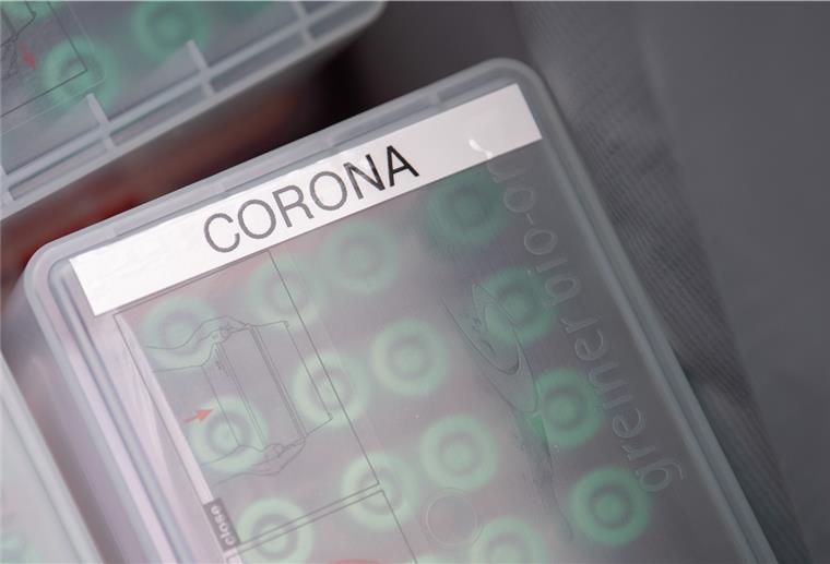 Coronavirus: 436 Neuinfektionen in Deutschland In Deutschland wurden am Sonntag 436 Infektionen mit dem Coronavirus gemeldet.