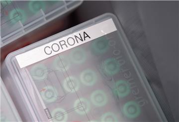 In Deutschland wurden am Sonntag 436 Infektionen mit dem Coronavirus gemeldet.