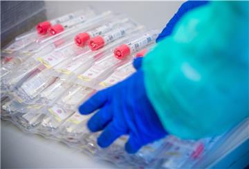 In Quarantäne befinden sich gegenwärtig 198 Personen.