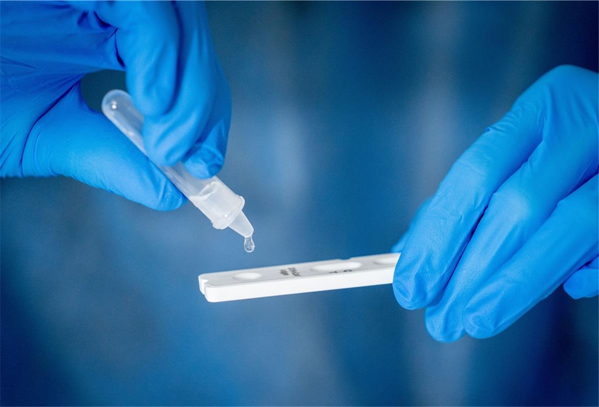 Erste Schnelltests erhalten Sonderzulassungen Medizinisch geschultes Personal träufelt nach dem Abstrich für einen Corona-Schnelltest in eine Lösung auf die Antigen Testkasette.
