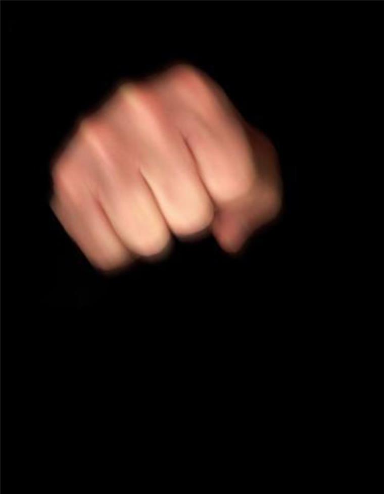 Mit der Faust ins Gesicht: Ein Mann ist in der Nacht auf einem Parkplatz an der Rudloffstraße zusammengeschlagen worden. 