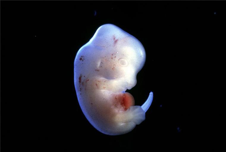 Mit solchen Rattenembryos wollen die japanischen Forscher künftig Organe mithilfe menschlicher Stammzellen
züchten. Wissenschaftlicher Fortschritt oder ethischer Verstoß?