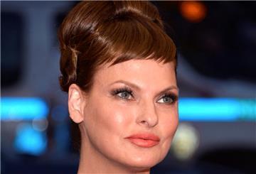 Model Linda Evangelista vor der Schönheits-OP