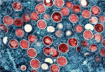 Mpox Klade IIb wird durch engen Körperkontakt übertragen, vor allem beim Sex. (Archivbild)
