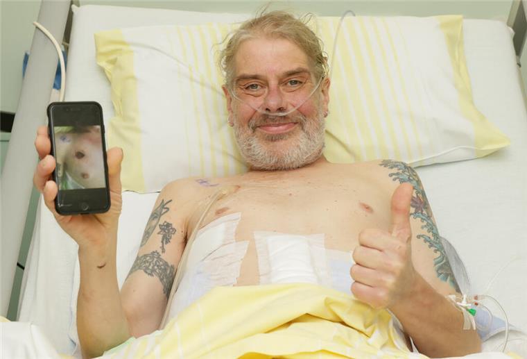 55-Jähriger wird von Zaunstange aufgespießt - und überlebt 