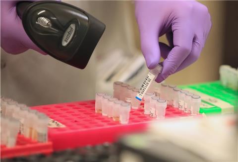 Proben werden in einem Labor auf Coronavirus (Covid-19) getestet.