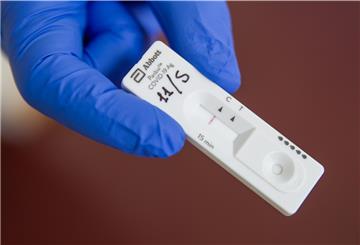 Schnelltests wie diese, hier ein Symbolfoto, können Bürger ab Montag unter anderem in dem Testzentrum im Spadener Gewerbegebiet machen lassen. 