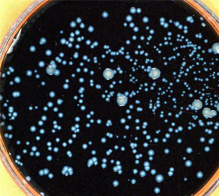 Ursache für Legionellen-Erkrankungen noch nicht gefunden So sieht eine Kolonie des Bakteriums Legionella pneumophila aus. Es löst die so genannte Legionärskrankheit aus.