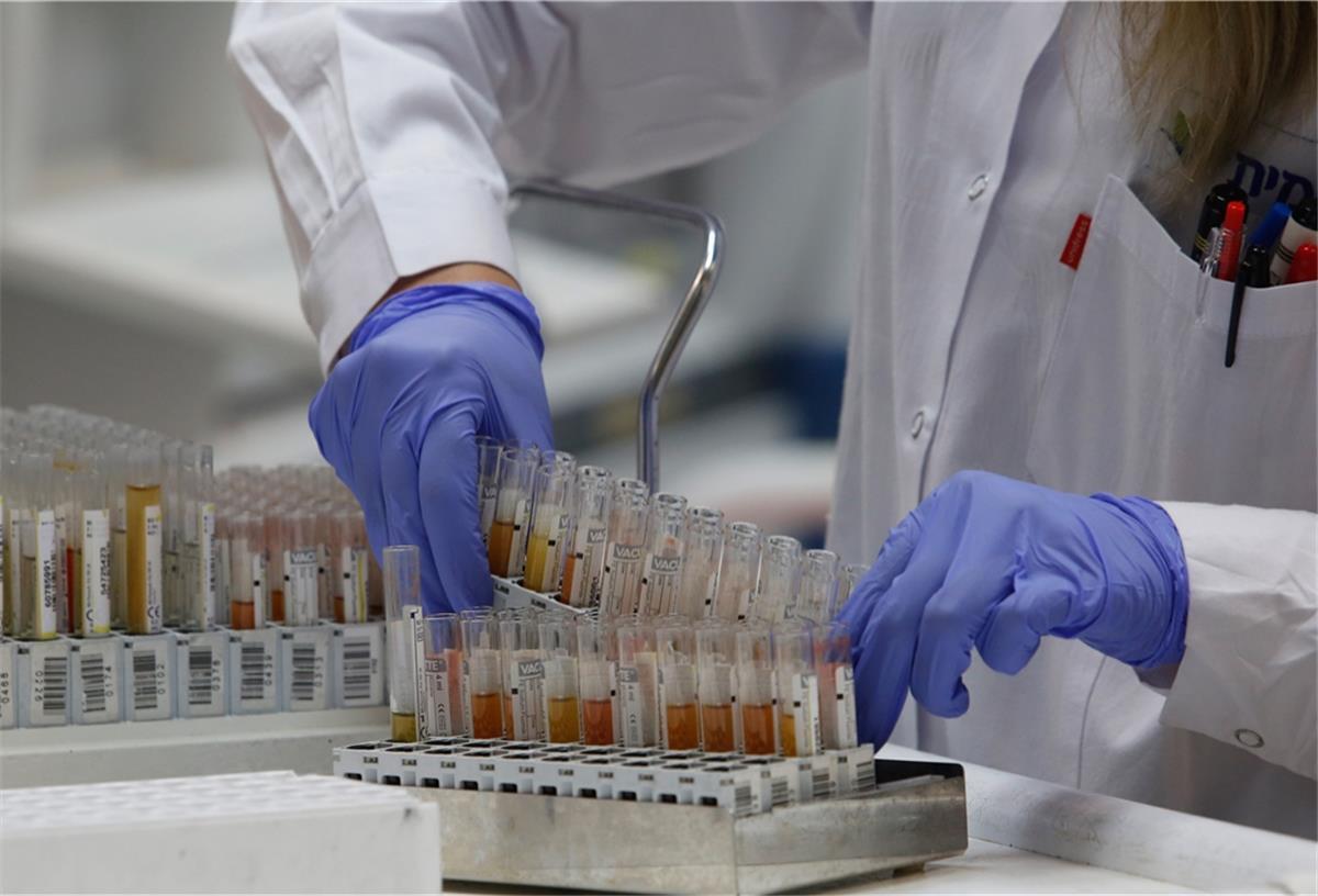 Symbolfoto: Corona-Tests werden in einem Labor untersucht.