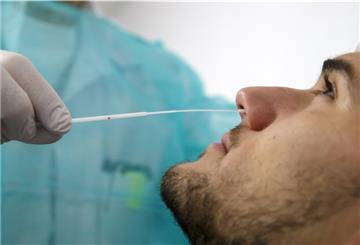 Test auf Coronavirus. Der Cuxhavener Mikrobiologe Dr. Egon Vielitz würde es begrüßen, wenn alle Menschen geimpft würden.