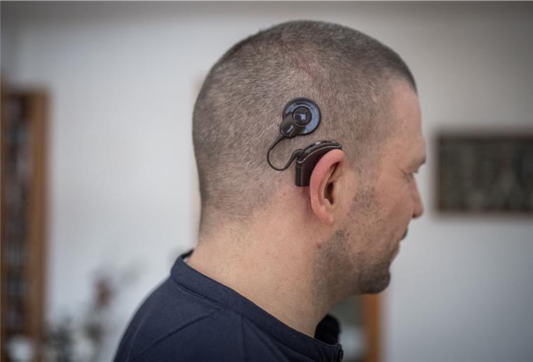 Timo Bilitza aus Spaden lebt nach dem Verlust seines Hörvermögens auf dem rechten Ohr nun mit einem Cochlea-Implantat.