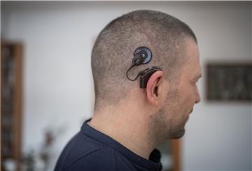 Timo Bilitza aus Spaden lebt nach dem Verlust seines Hörvermögens auf dem rechten Ohr nun mit einem Cochlea-Implantat.