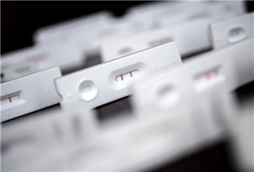 Antigen-Schnelltests für den Nachweis von SARS-CoV-2 liegen auf einem Tisch