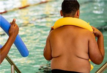 Ein übergewichtiger Junge steht mit einer Schwimmnudel am Rande eines Schwimmbeckens. 