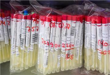 PCR-Tests von Patienten liegen im Labor Nordlab in einem Kühlschrank. 